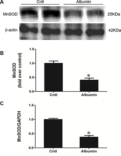 Effects of albumin overload on the regulation of MnSOD.