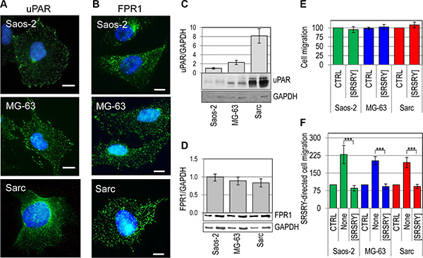 Inhibitory effect of [SRSRY] on migration of FPR1expressing osteosarcoma and chondrosarcoma cells.