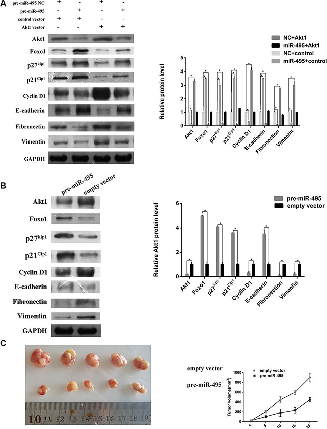 miR-495 represses cell cycle signaling, inhibits epithelial-mesenchymal transition by directy targeting Akt1 to suppress ESCC progression in vitro and vivo