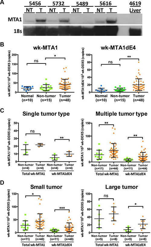 Expression of wk-MTA1 mRNA in normal, nontumor, and tumor liver tissues from woodchuck autopsy samples.