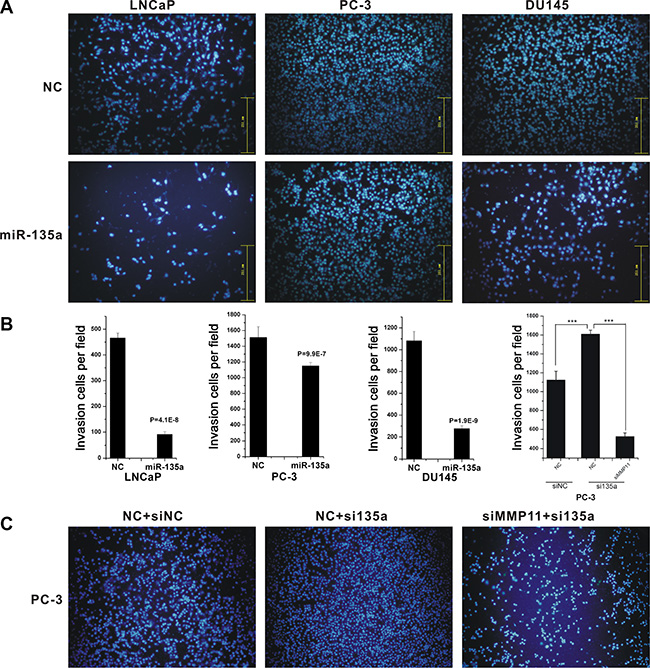 MiR-135a inhibited cell migration and invasion.