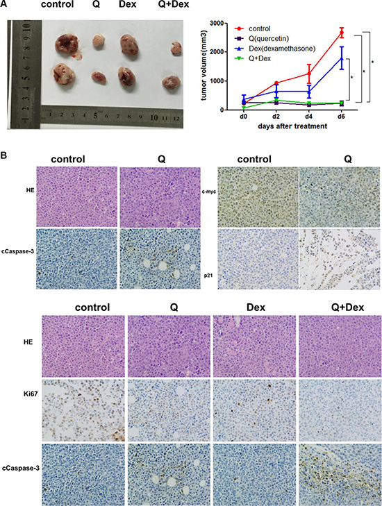In vivo effects of quercetin or quercetin + dexamethasone treatment on established myeloma in NOD&#x2013;SCID mice.