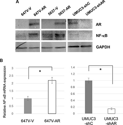 Effects of AR on NF-&#x03BA;B expression in bladder cancer cells.