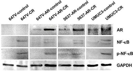 The expression of AR, NF-&#x03BA;B, and p-NF-&#x03BA;B in CR bladder cancer cells.