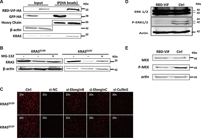 RBD-VIF mediates the degradation of mutant KRAS through Vif-mediated ubiquitin system and inhibits the downstream of MAPK-ERK pathway.