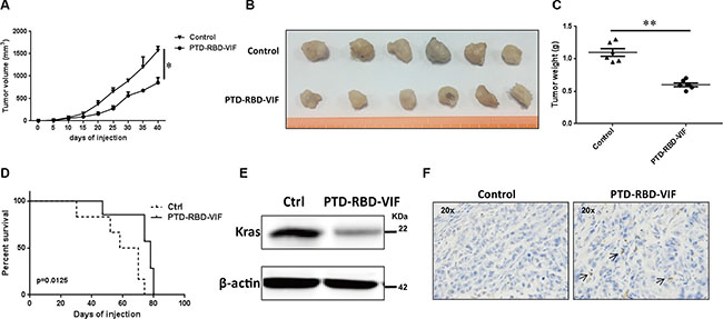 PTD-RBD-VIF potently inhibits pancreatic tumor growth with intraperitoneal injection in vivo.