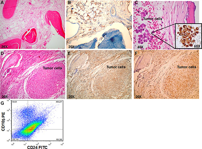 RCC stem cells efficiently metastasize to bone.