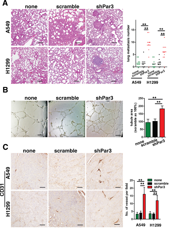 (PDF) Autologous Bone Marrow Stromal Cells Genetically 