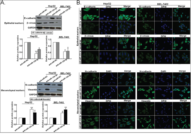 Methylation-associated silencing of microRNA-129-3p promotes epithelial ...