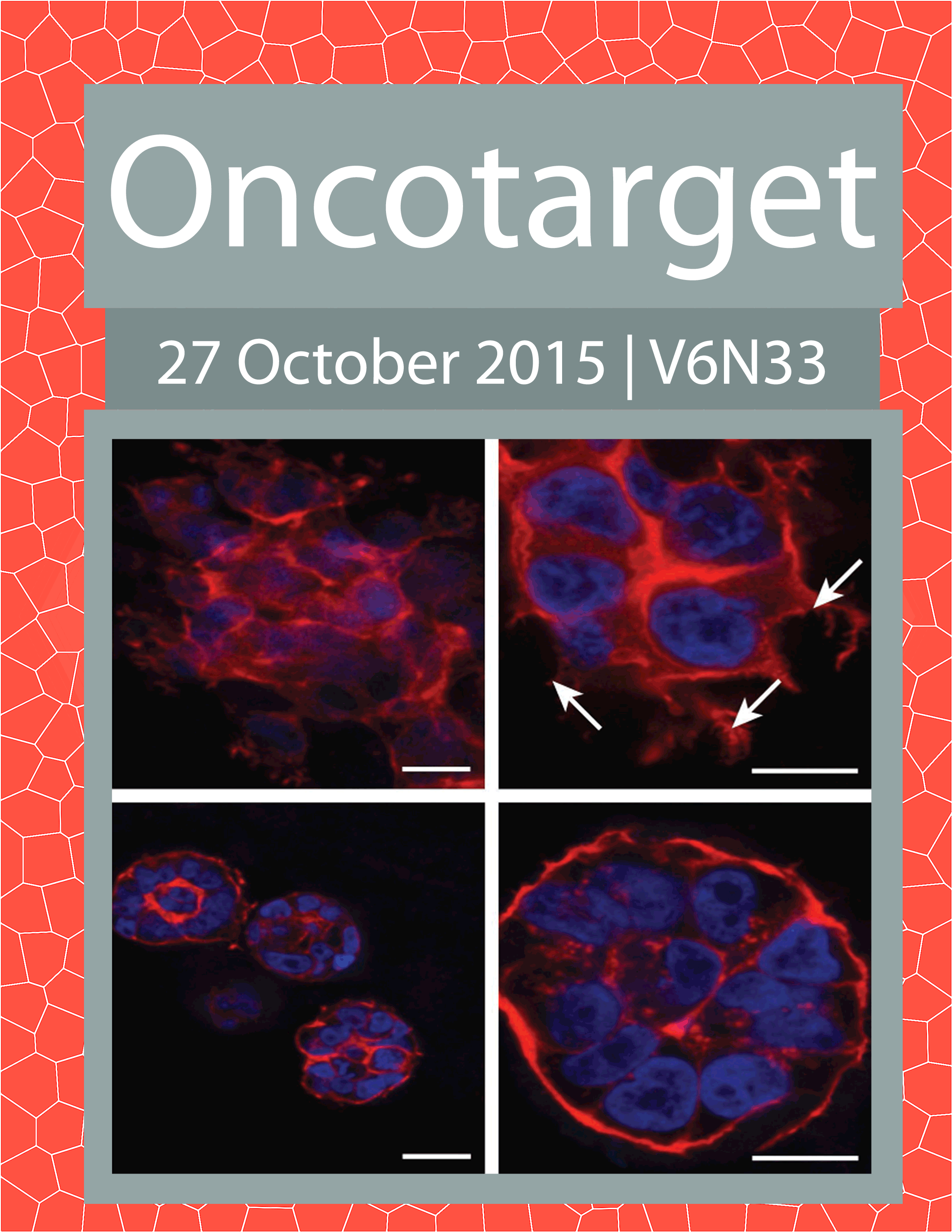 Journal Cover for Oncotarget V6N33