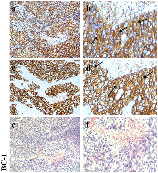 CD147 knockdown improves the antitumor efficacy of trastuzumab in