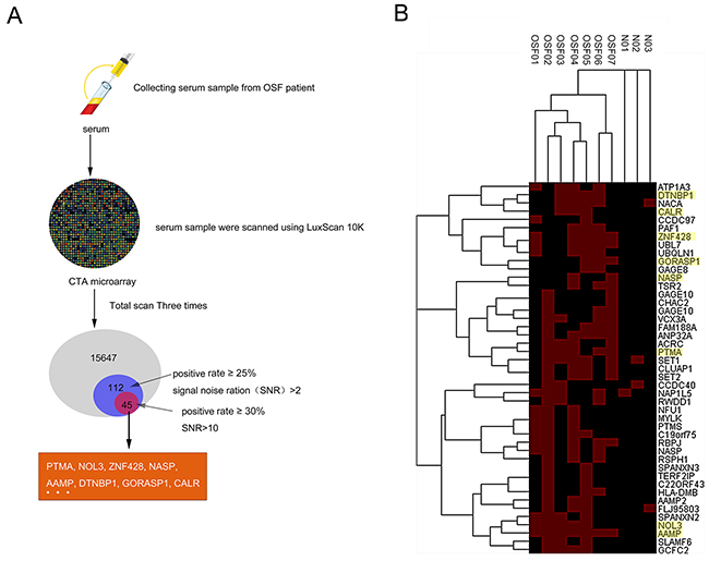 PTMA a new identified autoantigen for oral submucous fibrosis