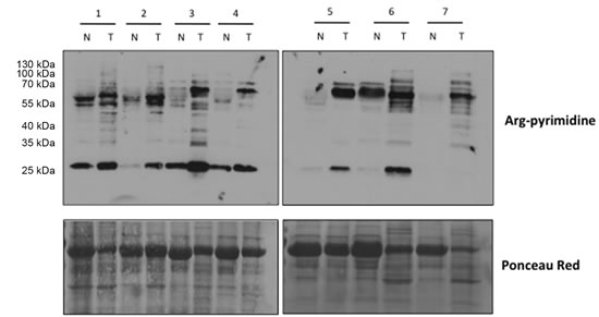 bromo benzyl glutathione cyclopentyl diester EP4512427A1 - Antibody-drug conjugates based on molecular glue degraders and uses thereof Molecular Assessment of Methylglyoxal-Induced Toxicity