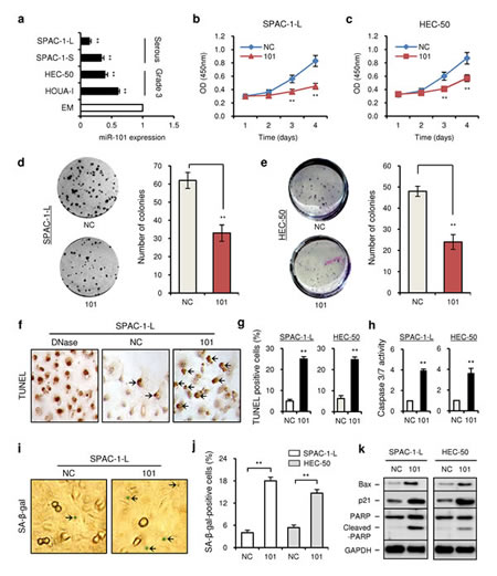 MicroRNA-101 targets EZH2, MCL-1 and FOS to suppress proliferation