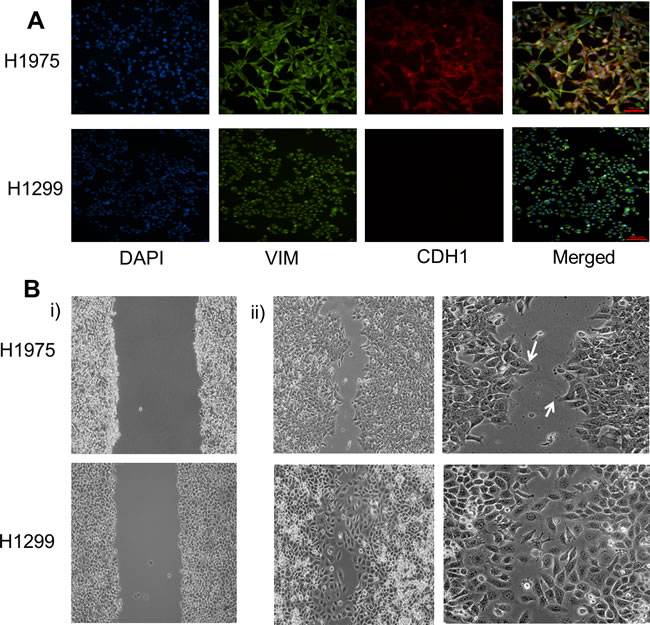 その他 N Stability of the hybrid epithelial/mesenchymal phenotype | Oncotarget